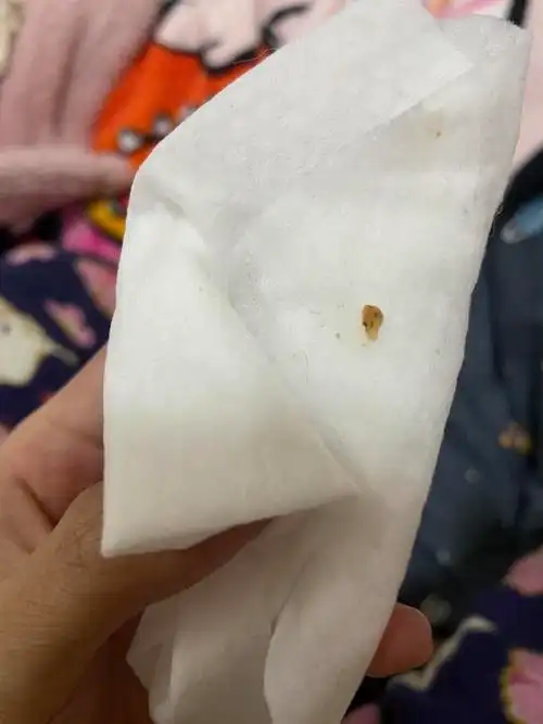 姐妹们请问这是绦虫节片吗