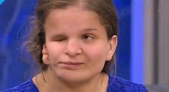 因为太丑母亲说整容才能回家,结果女孩在手术中离世