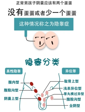 医生说._睾丸_治疗_阴囊