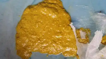 问:近两天宝宝大便是这样的,粘稠,有疙瘩,量大,有酸臭味,是什么原因呢