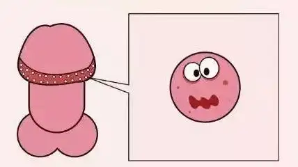 丁丁上长小疙瘩,红点,怀疑是出现性病了吗?_包皮_龟头_治疗