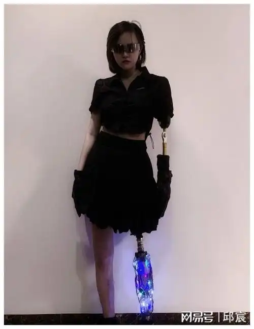 闺蜜超速驾车致车祸后,女孩残疾又被分手|截肢|假肢|残肢_网易订阅