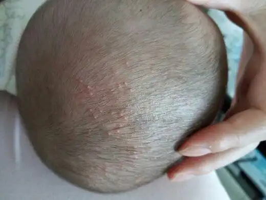 我宝宝头上长得是什么啊!在线等啊