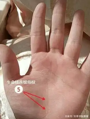 身体有癌症病兆的人,其手纹特征!