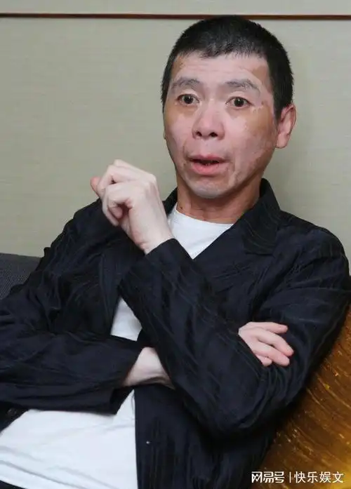 65岁冯小刚患病后放弃治疗多方求医无效仍自愈皮肤光滑显年轻