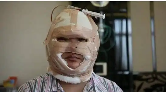 她是选秀钉子户资质平平不认命整容变毁容