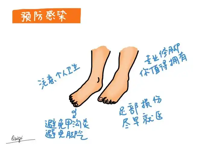 糖尿病足从恐惧到了解