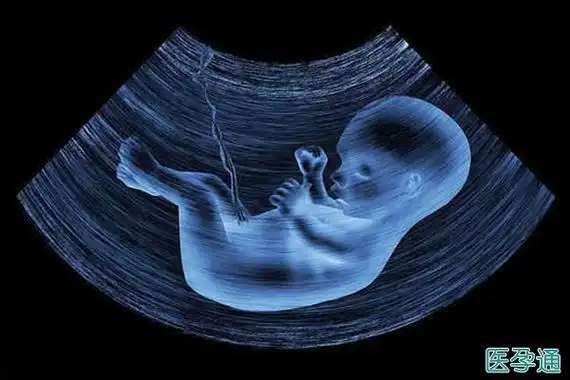 胎囊是怀孕最开始的形状,是初始的胚胎机构被羊膜,毛细血管网包囊的小