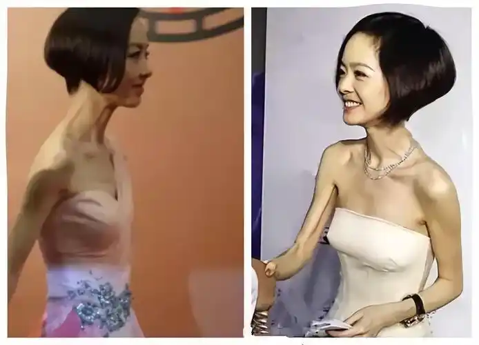 暴瘦的"纸片人"女星,有人瘦到33公斤,体力不支坐轮椅