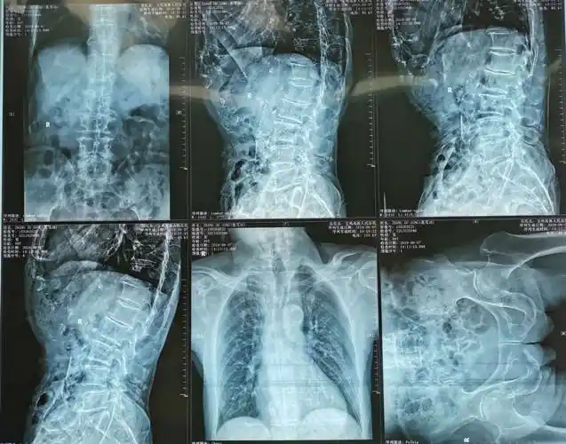 高新人民医院—陈广儒的美篇