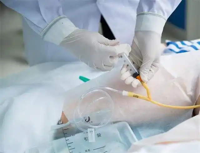 留置尿管为什么还是想排尿?遇到这种情况怎么处理