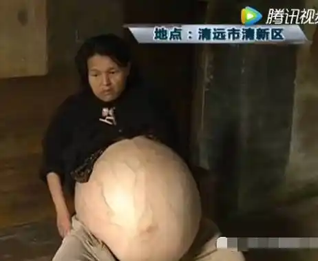 广东女子挺着大肚子5年,但是却一直"没生孩子"!医生也不知道原因