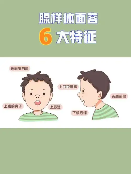 【儿牙科普】孩子口呼吸腺样体面容主要特征