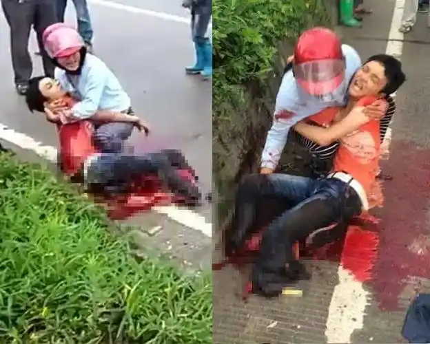 经医生会诊,孩子双腿因遭严重碾压骨肉血管模糊不全已无接回的可能