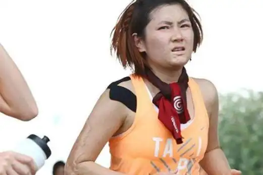 任家萱烧伤前后对比