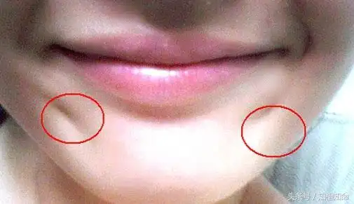 梨涡什么意思(梨涡少年什么意思)