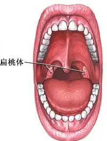 扁桃体是什么