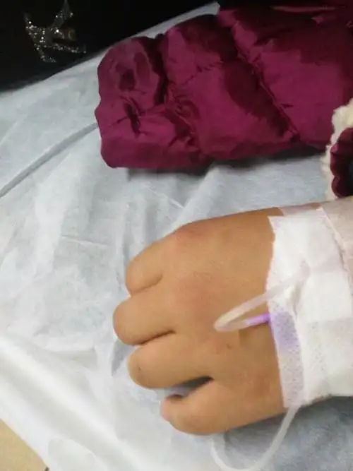 半夜挂急诊吊针宝宝没事吧