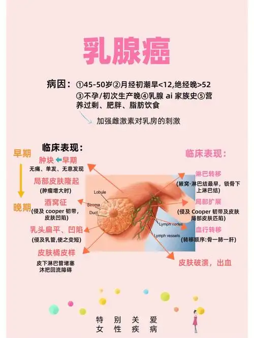 医生乳腺癌笔记