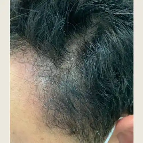 头皮_问题_成分