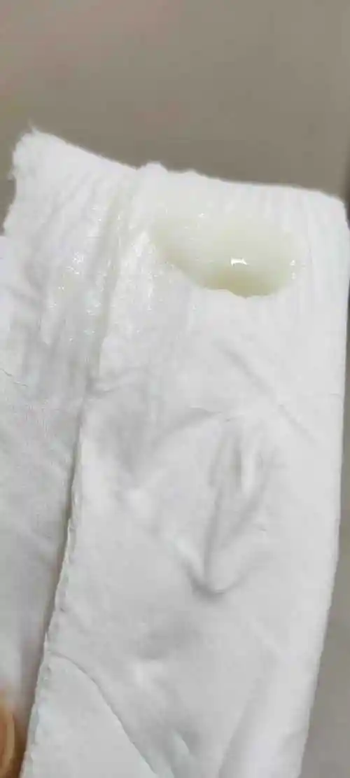 白带酸奶稠浆糊状 一年了 啊啊啊 崩溃