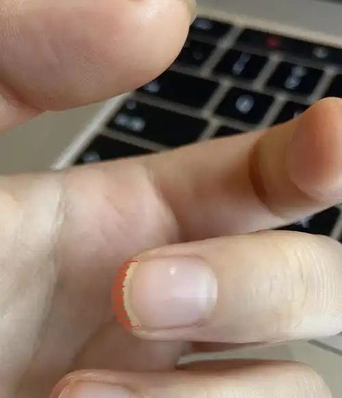 指甲剪成锯齿状忘修剪被围观