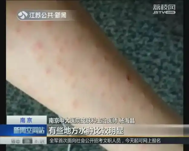 大爷为杀螨虫给凉席喷敌敌畏,你猜结果怎么着?