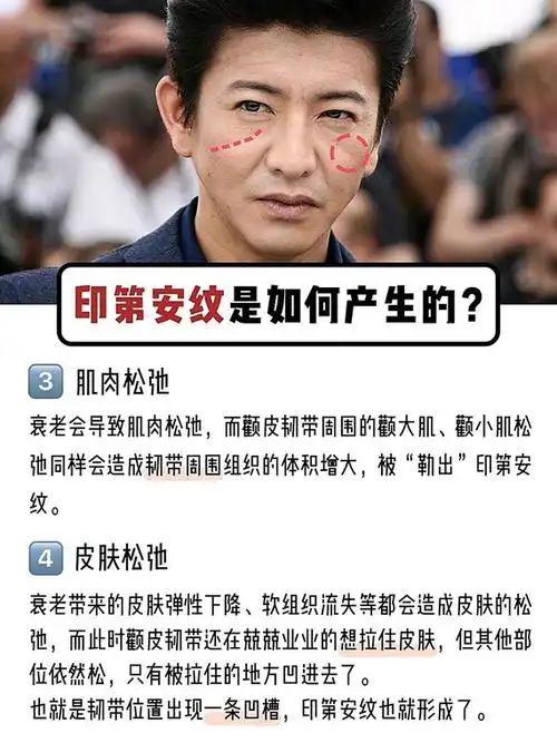 宋茜昆凌脸上的印第安纹最全解决方法60