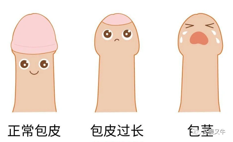 龟头是哪里包茎自翻步骤图片