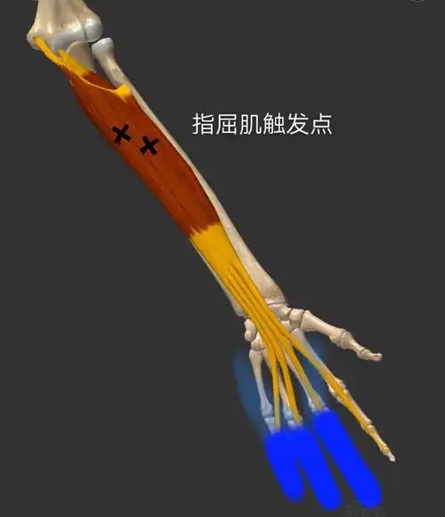 简介:指屈肌分两层:指深屈肌和指浅屈肌.