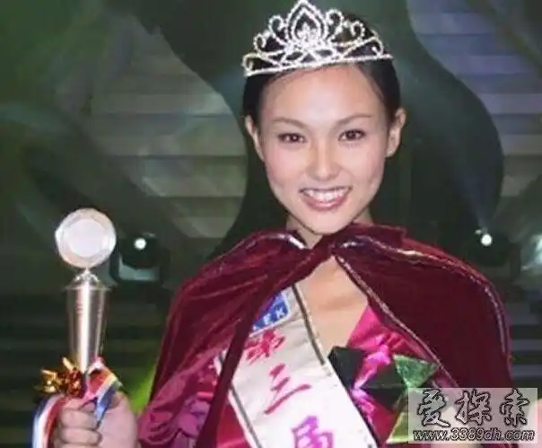 唐嫣整容前后照片对比原来傻白甜是这样炼成的