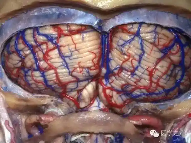 医学图片|逼真的脑组织解剖图_大脑