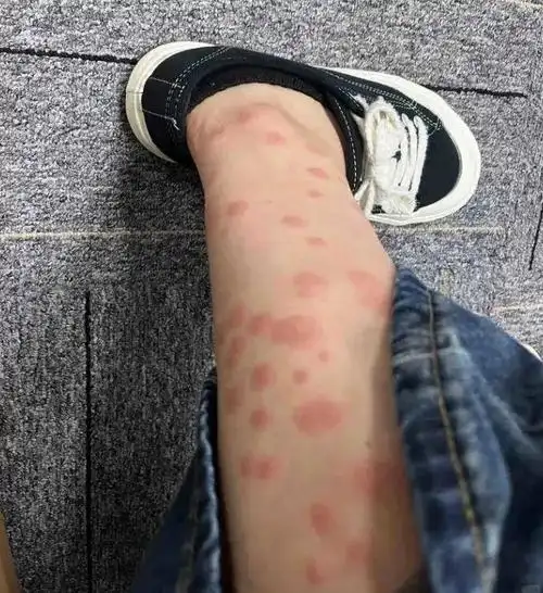 10年未见的女同学深夜发来"腿"照,我惊出一身冷汗