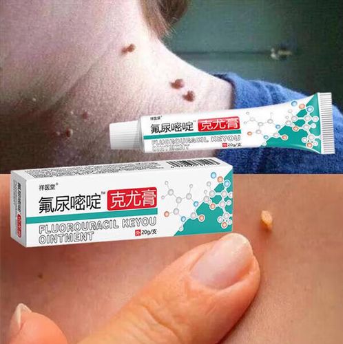 克尤膏脖子肉粒扁平尤面部灵膏脖子胸口上长肉粒脖子腋下丝状小肉粒