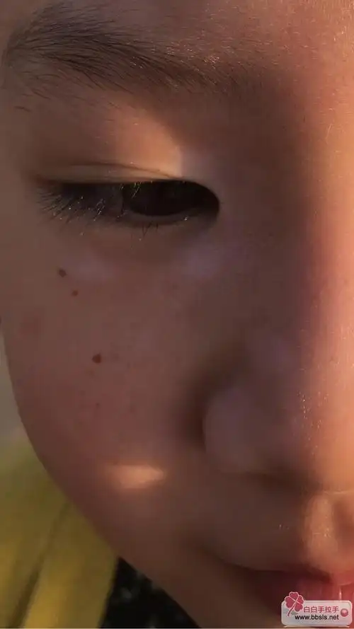 亦宁傅士帮我看看小孩子脸上长了好多黑点点怎么回事会自己消失吗