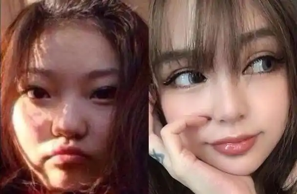 郑爽整容后,整容的明星(郑爽,整过容吗)_娱乐八卦_