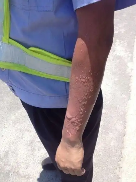 交警每天两个班次,总计5小时左右,下午班时间比较长,受到烈日暴晒也