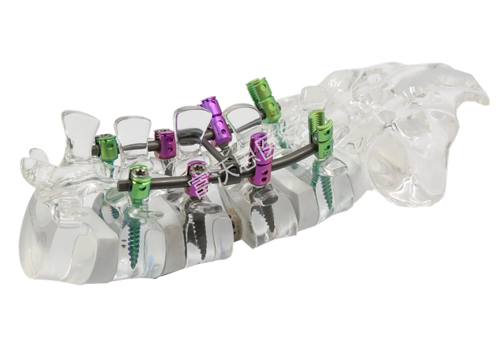 脊柱胸腰椎后路钉棒内固定系统