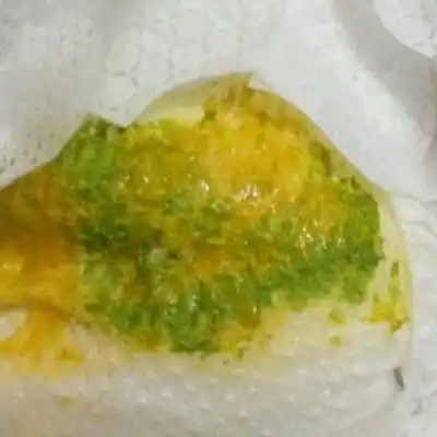 半个月宝宝大便怎麼看,图片这样的是什麼问题?