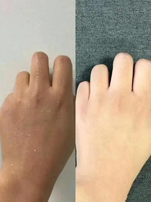 手就能看出来这个女生是不是很美,所以晒黑了手就相当于是晒黑了"脸"