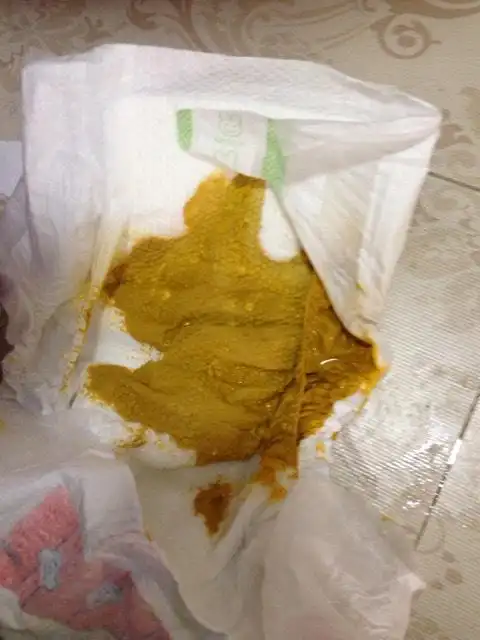 肠道菌群失调或者受凉引起的症状,需要化验大便常规或者服用妈咪爱