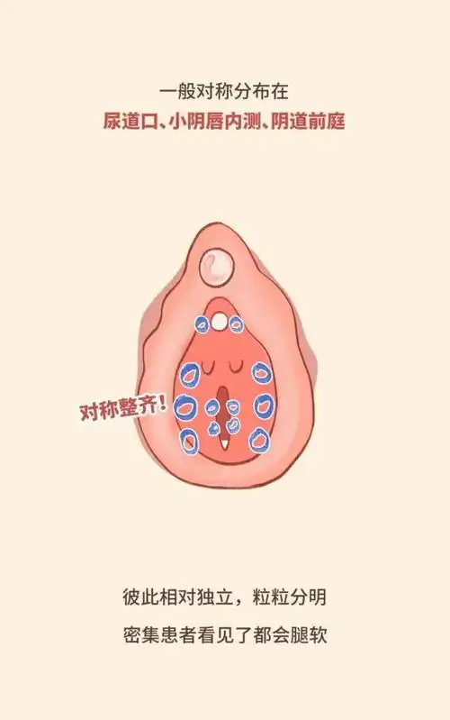 不要小看这一圈肉疙瘩它们是伴侣间的定时炸弹女性安全指南172