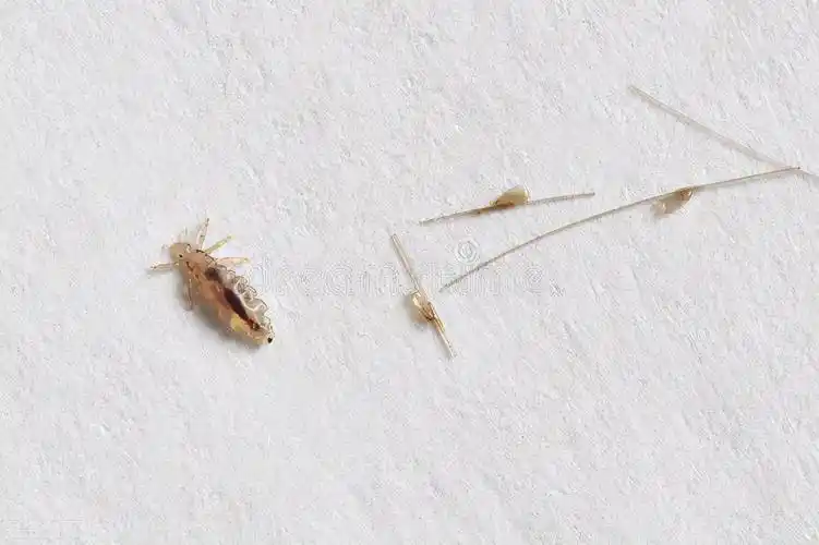 女子下身瘙痒,镊子夹出9只阴虱虫!医生提醒:有4种表现要警惕