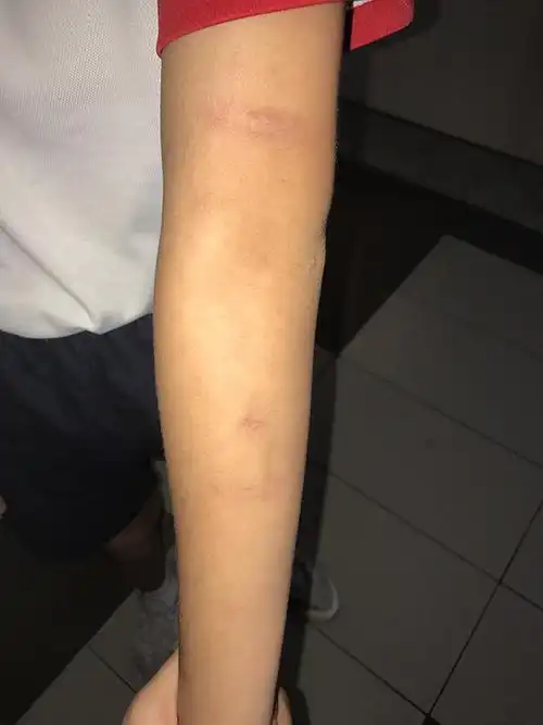 家长怒指训导主任滥罚 小六生挨6鞭 警列蓄意伤人案