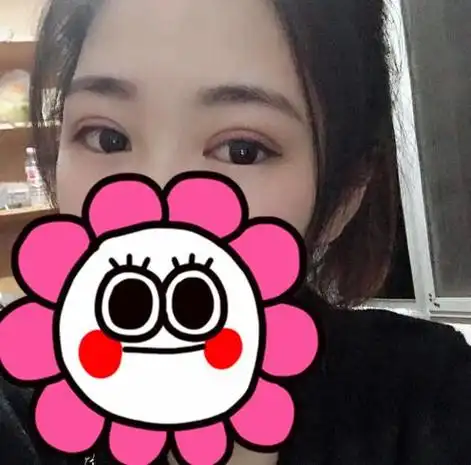 今天为各位带来全切双眼皮8毫米恢复图,全切双眼皮作为一种比较常见的