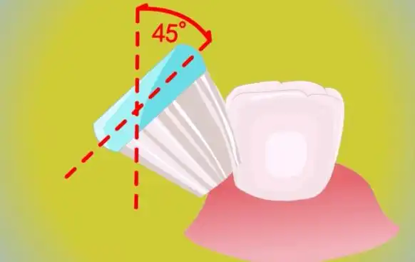我每天刷牙怎么还是有蛀牙呢