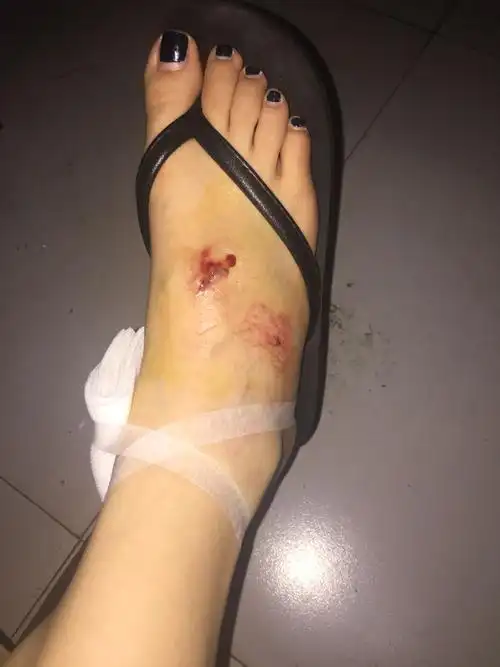 骑电动车被车撞了 对方全责 但是现在医药费都是自己垫付 对方不照面