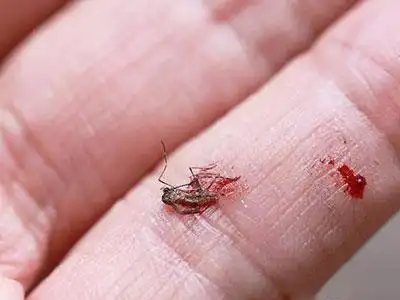 把正在吸血的蚊子拍死竟有这后果