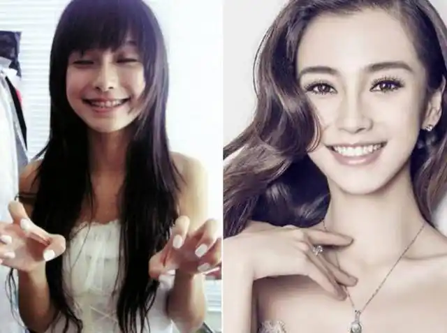 杨颖15岁照片曝光,被网友质疑整容,回应:是整牙不是整容