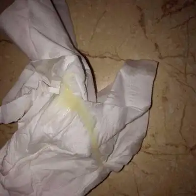 两性健康_妇科疾病健康经验分享_第127页_39问医生_39健康网